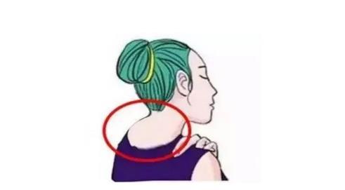 富貴包怎樣徹底消除,富貴包拔罐會(huì)好嗎?