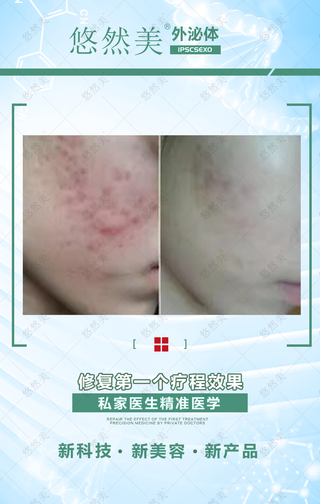 外泌體有什么功效與作用，正規嗎   來看一下部分案例
