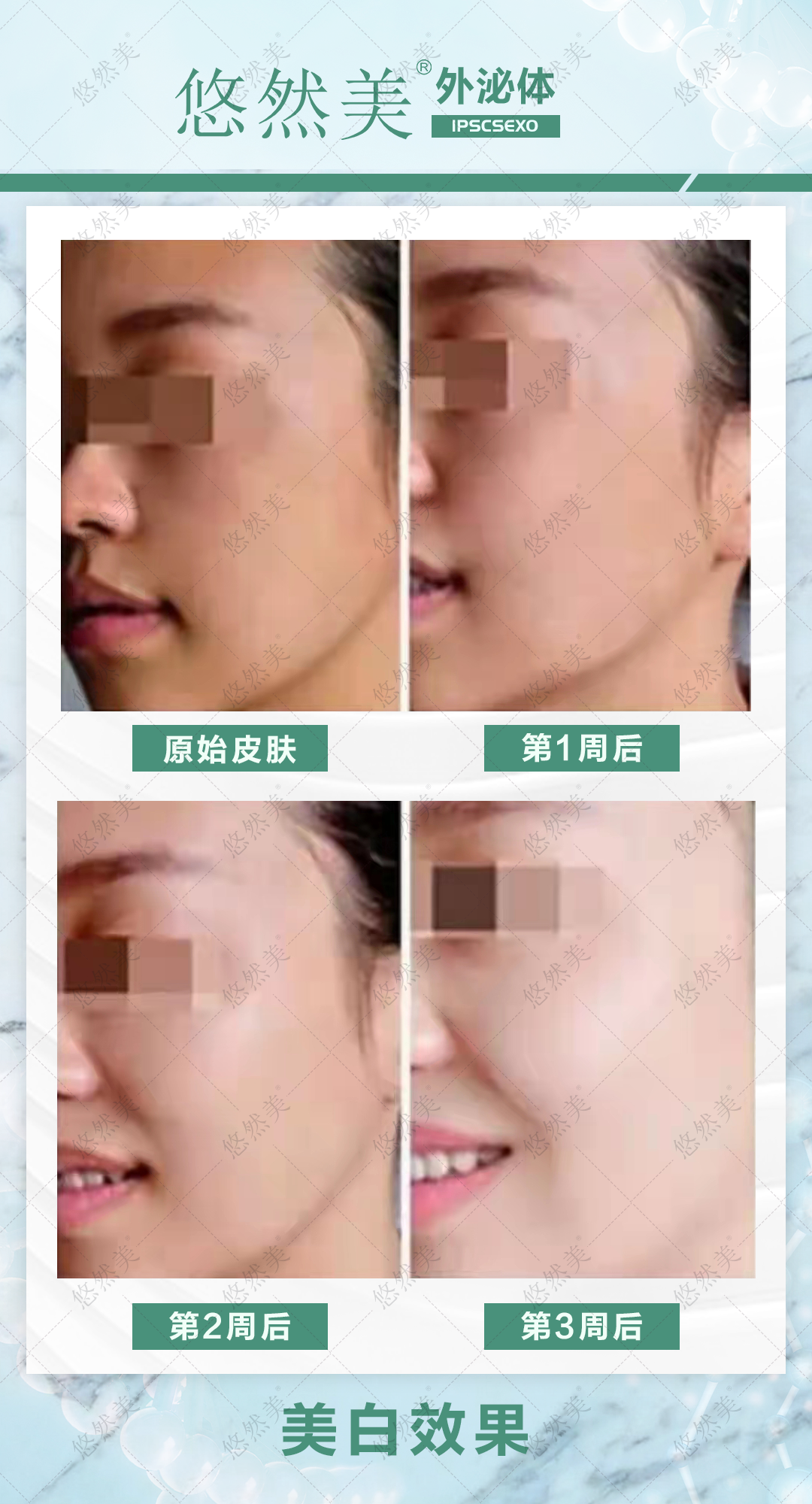 外泌體有什么功效與作用，正規嗎   來看一下部分案例