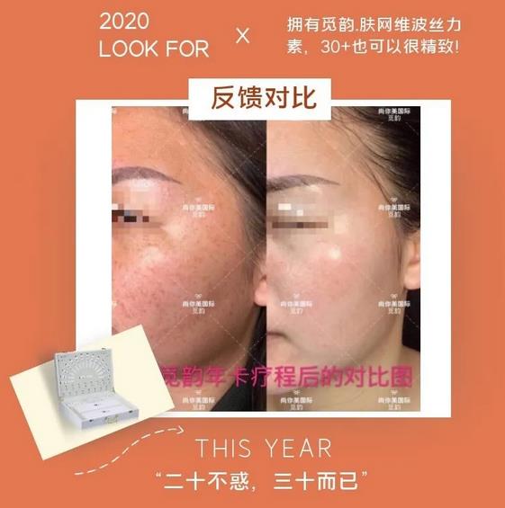 覓韻膚網效果反饋