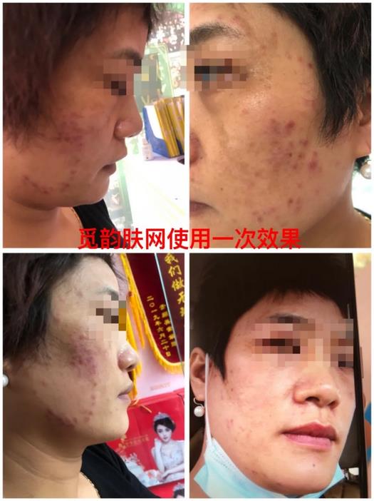 覓韻膚網效果反饋