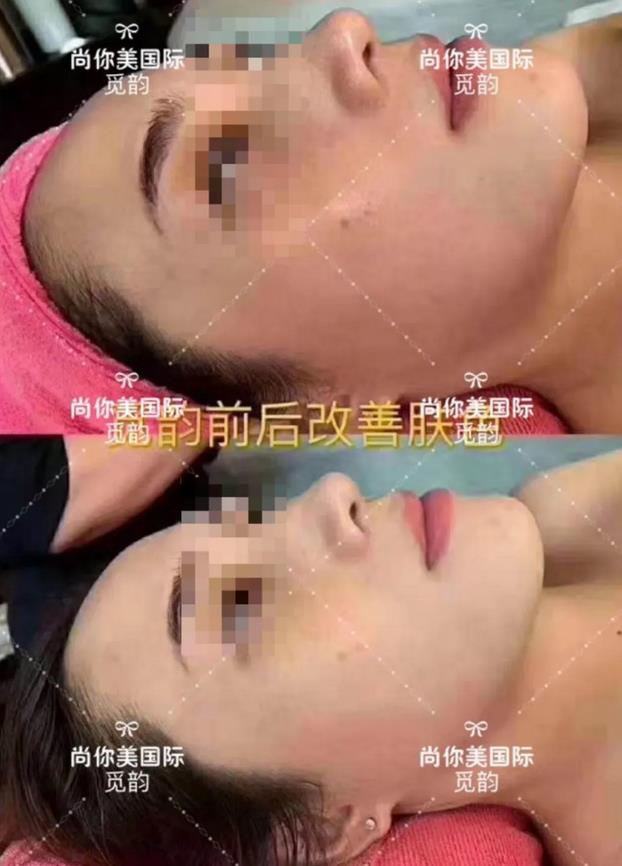覓韻膚網效果反饋